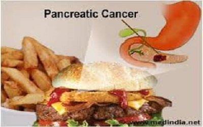 high-fat-high-calorie-diet-may-cause-pancreas-cancer-in-mice